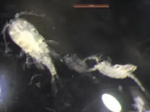 Copepods