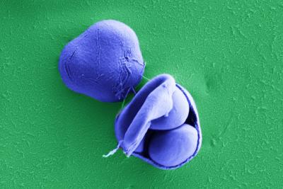 <em>Saccharomyces paradoxus</em>