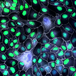 Leaders that are not eliminated compromise tissue architecture