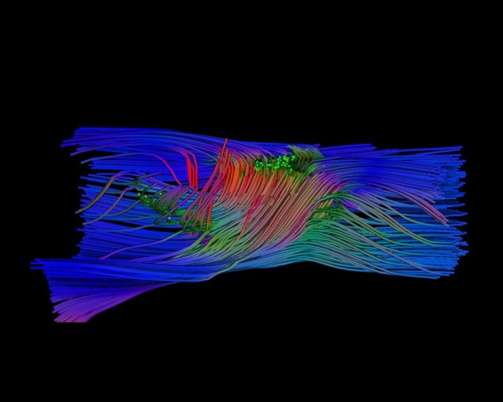 Fiber tract MRI