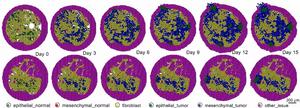 PhysiCell pancreatic cancer simulation