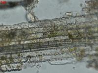 Switchgrass Decomposing in Cow Rumen
