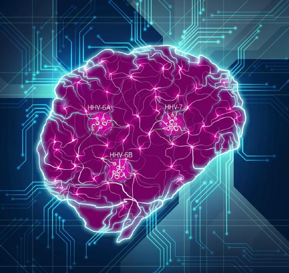 Brain Disrupted by Herpesviruses