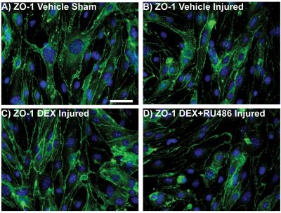 Increased Tight Junction Immunostaining