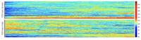 Hair pigmentation patterns