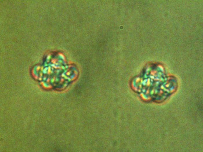 Vortex knots inside a chiral nematic liquid crystal