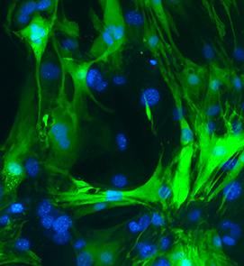 Cardiomyocytes