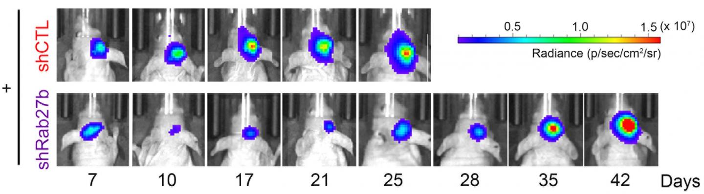 Combined Effect of Rab27b Knockdown and Radiation Therapy on GBM in Mice
