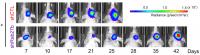 Combined Effect of Rab27b Knockdown and Radiation Therapy on GBM in Mice