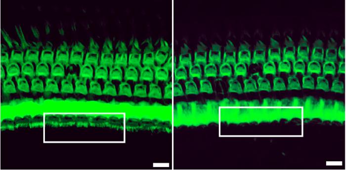 Stereocilia