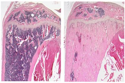 WNT7B Stimulates New Bone