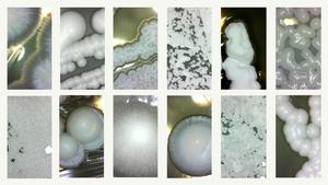 Yeast montage