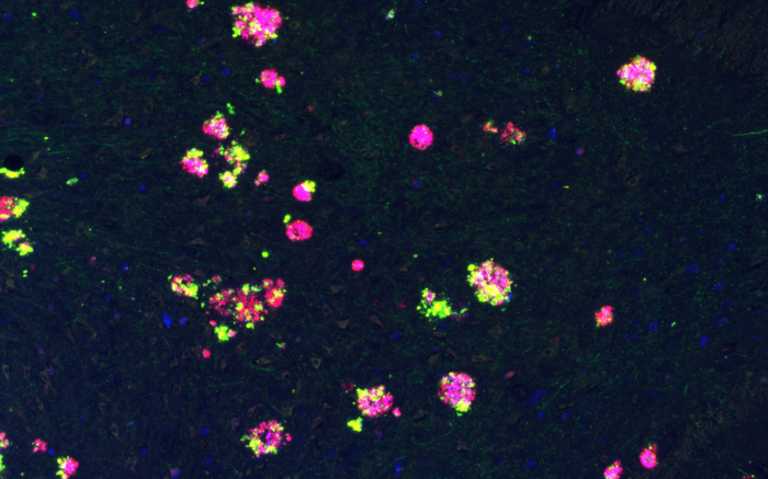 APP forms clusters around amyloid plaques