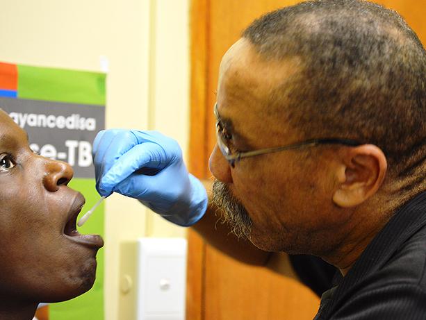 Oral Swab for TB