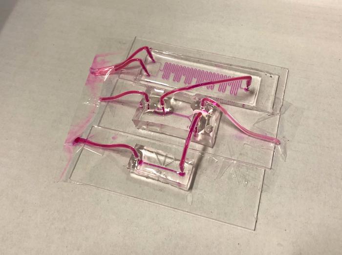 New Monitoring Technology Could Help Identify More Donor Lungs for Transplantation
