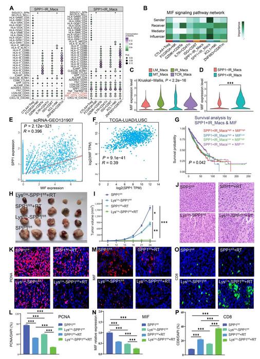 图2：靶向SPP1+肿瘤相关巨噬细胞可增强放疗联合治疗的抗肿瘤免疫反应
