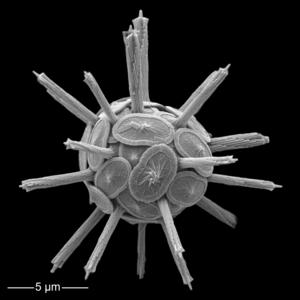 Coccolithophore_Rabdosphaera-clavigera_EMed_PZiveri