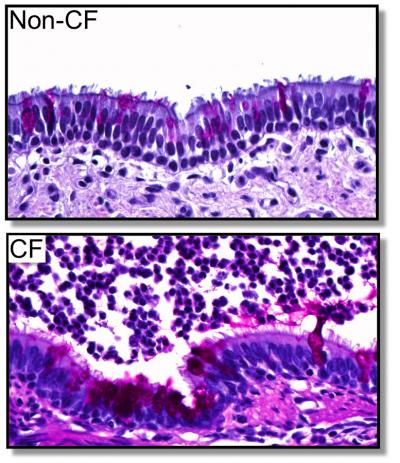 Airways of CF and non-CF Pigs