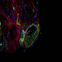 Hydrogel-Microfiber Composite with Human Cells