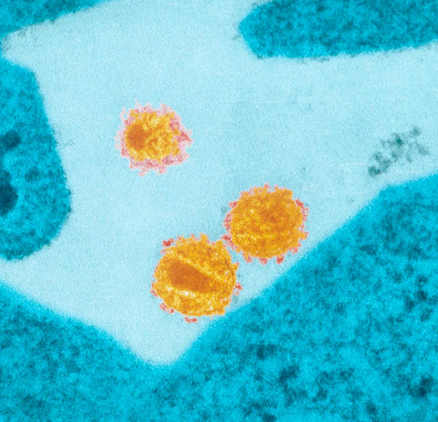 HIV Virus Particles