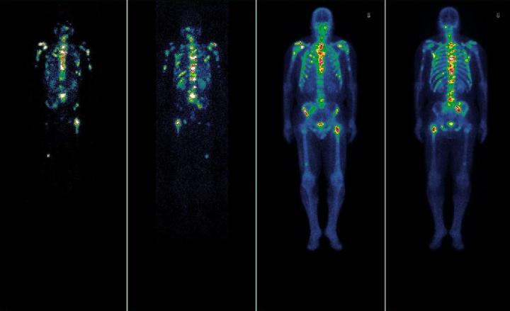 PSMA Color Imaging