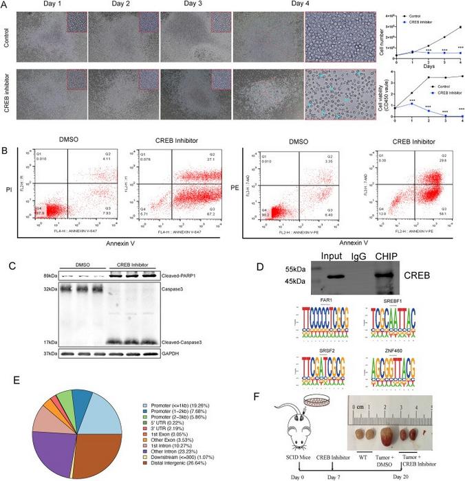 CREB inhibitor inhibited human B-lymphoma cell proliferation.