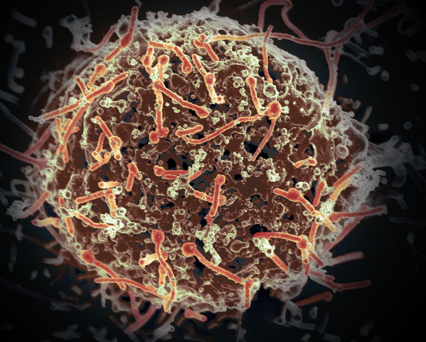 Ebola Virus, Isolated from Patient Blood Samples Obtained in Mali