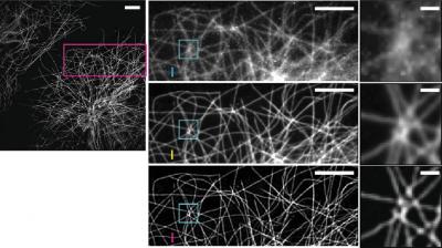 Super Resolution Microscopy