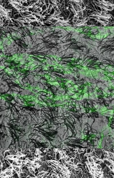 Scanning EM of the Ependymal Surface