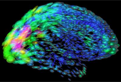 Epileptic Seizures May Be Linked to an Ancient Gene Family