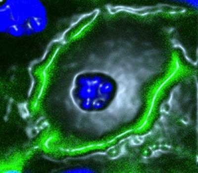 Fatty Liver Disease Prevented in Mice