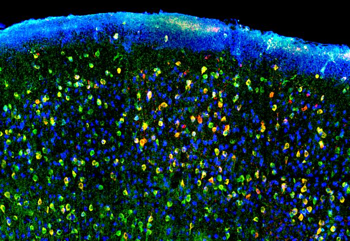 Mouse brain tissue, green blue yellow