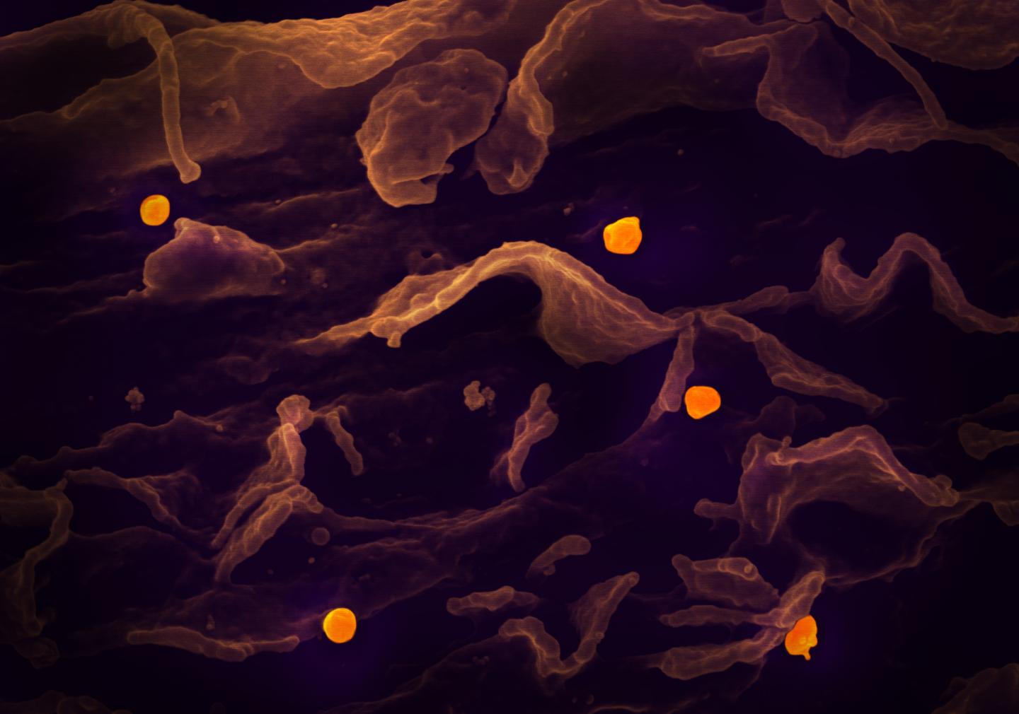 Experimental Antiviral for Ebola Protects Animals from Nipah Virus (2 of 2)