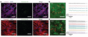Cardiac cells