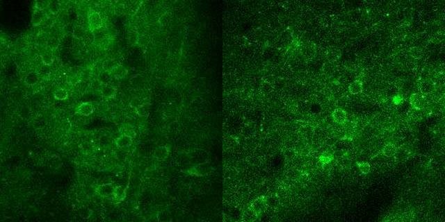 How Nicotine Acts on the Brains of Schizophrenic Patients