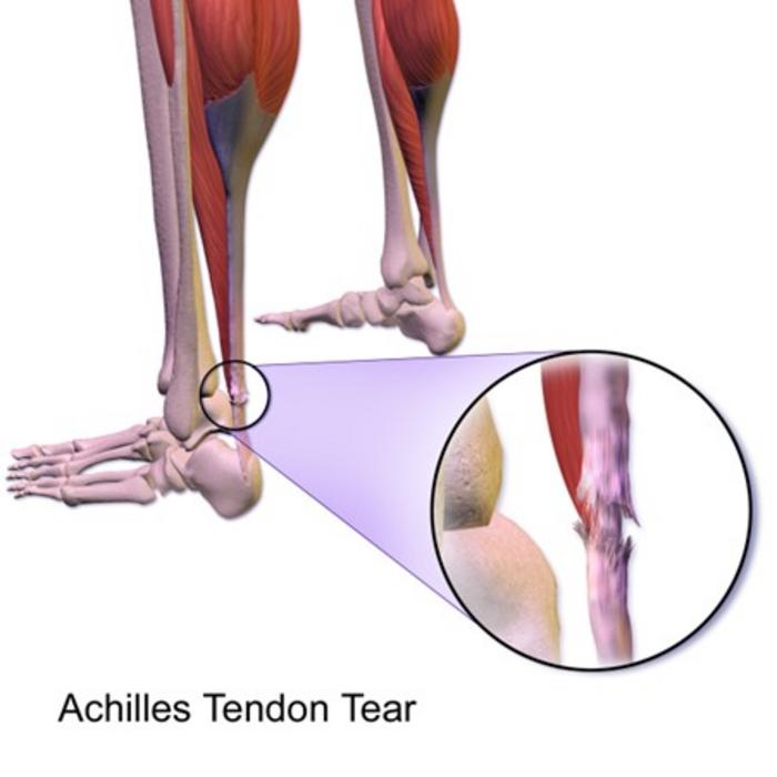 Tendon repair and healing get a new lease of life