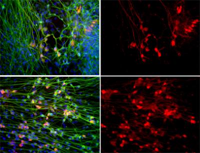 A Novel Human Stem Cell-based Model of ALS Opens Doors for Rapid Drug Screening