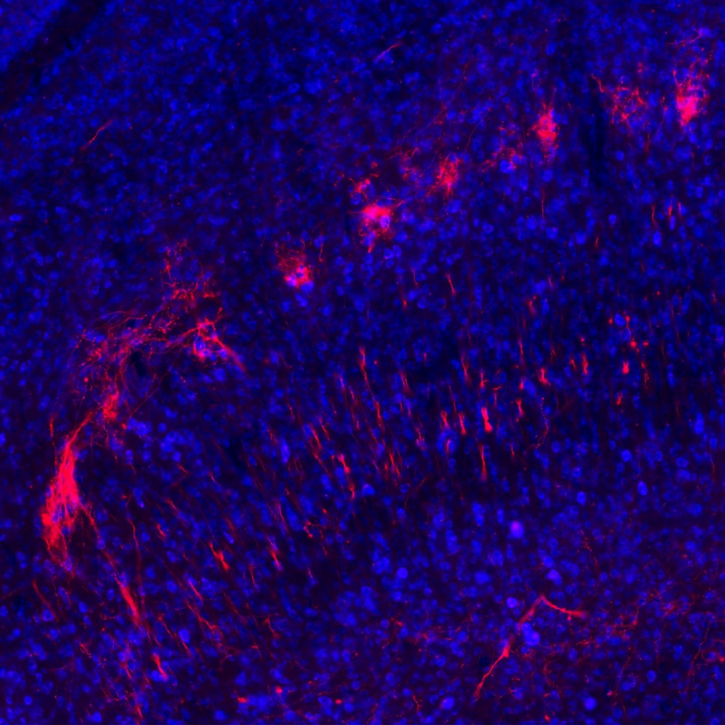 Axon branches