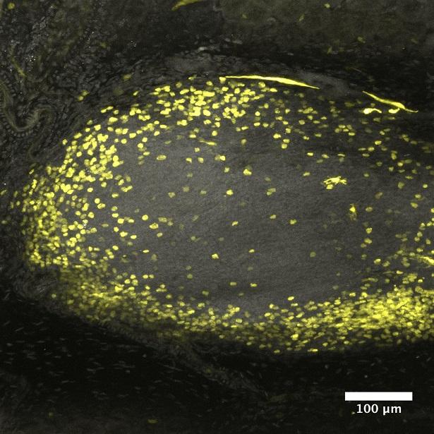 Immune Cells in Colon