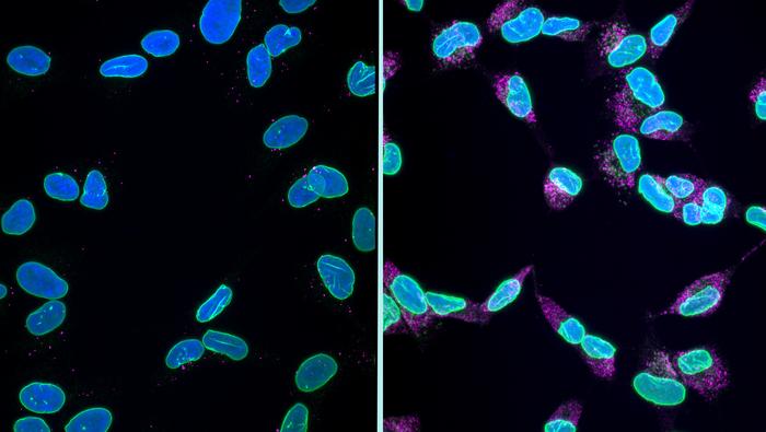 Healthy nuclei compared to shrivelled nuclei showing si of karyoptosis cell death mechanism