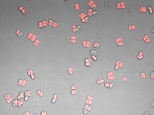 deinococcus radiodurans