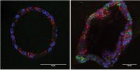 Cells that Drive Breast Cancer Relapse Have Altered Metabolism