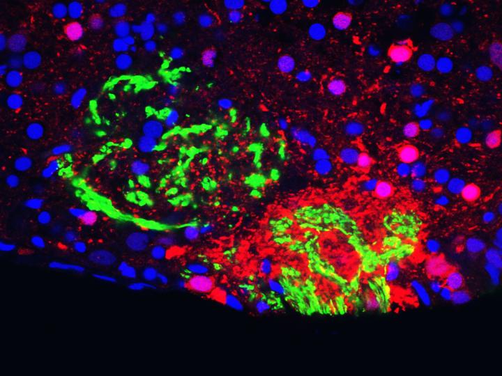 An Entry Point of Pheromonal PGF2alpha Information in the Brain