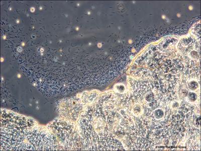 Malaria Sporozoites