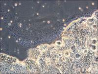 Malaria Sporozoites