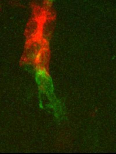 Trachea Development in the <i>Drosophila</i> Fly