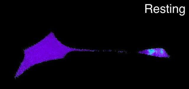 Columbia Scientists Identify Key Cells in Touch Sensation