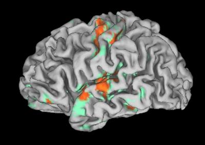 Brain View