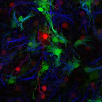FoxJ1+ Cells