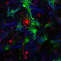 FoxJ1+ Cells